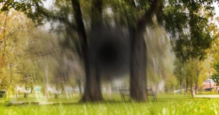 Macular Degeneration