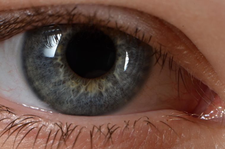 Dilated Pupils: Check Your Symptoms and Signs | Eye Pain Center