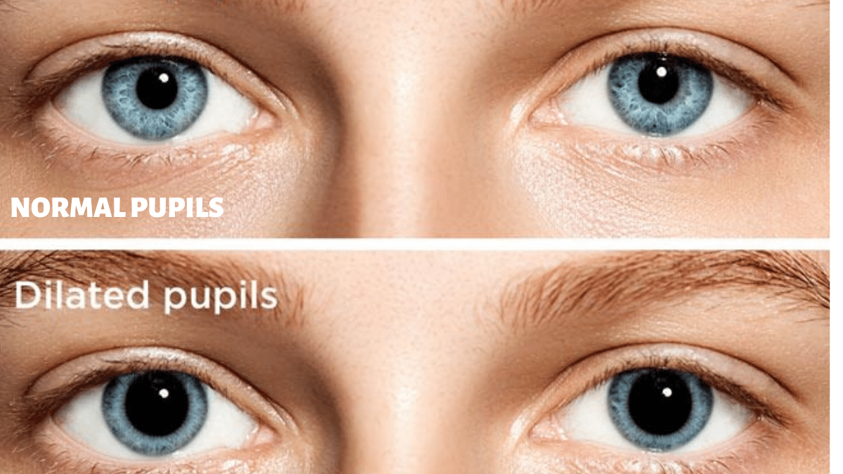 normal vs dilated pupils